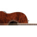 Ovation CS24P-NBM Celebrity Standard Plus Mid Cutaway Nutmeg Burled Maple электроакустическая гитара с вырезом